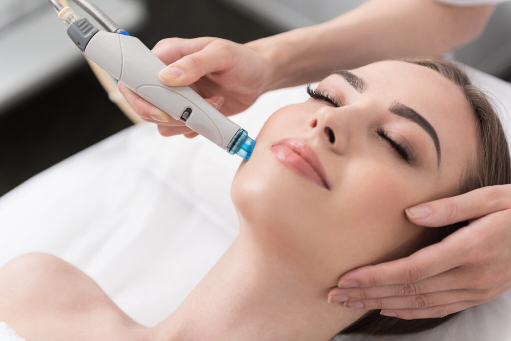 A photo of a beautiful blonde woman getting micro needling treatment.