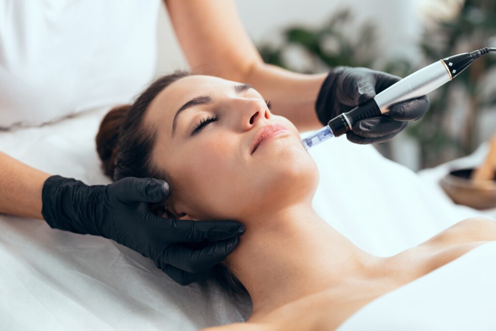 A photo of a woman getting microneedling treatment on her face.