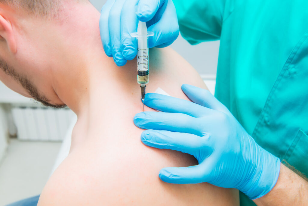 A photo of a man getting a trigger point injections in his shoulder.